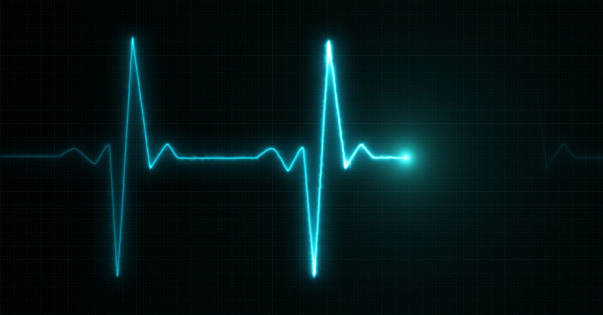 What is the purpose of employee pulse surveys?